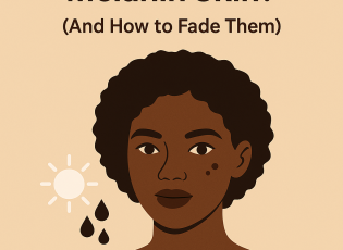 Illustrated infographic of a Black woman with dark spots on her face, explaining how pimples turn into dark marks on melanin-rich skin. Beige background with sun and droplet icons, and bold text reading ‘How Pimples Turn Into Dark Spots on Melanin Skin and How to Fade Them