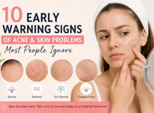 10 Early Warning Signs of Acne and Skin Problems Most People Ignore